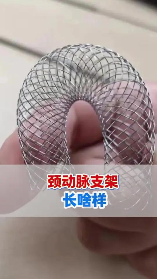 看看颈动脉支架长啥样热门颈动脉支架颈动脉狭窄粥样硬化斑块脑梗塞