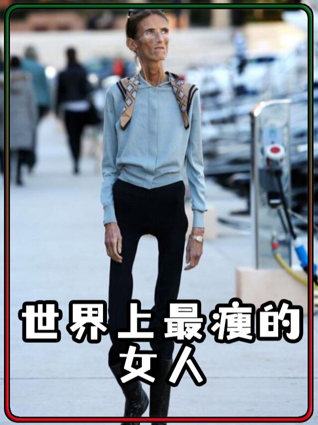 世界上最瘦的女人,仅40斤,你还敢减肥吗?