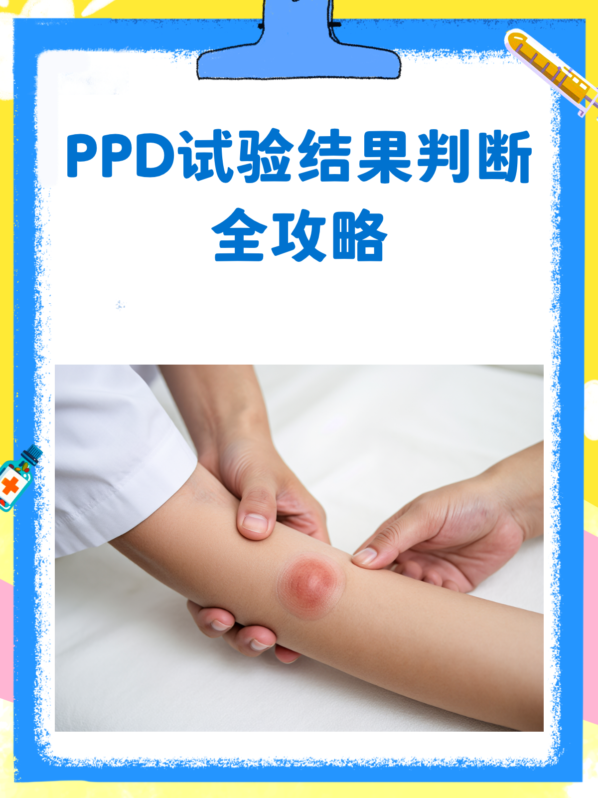 ppd试验结果,这样看就对了!