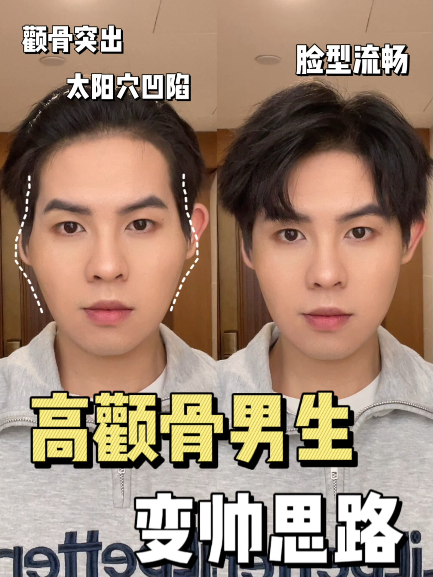 高颧骨菱形脸男生3个变帅技巧提升颜值
