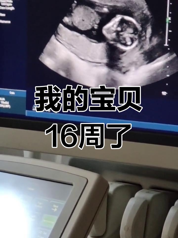 16周宝宝在妈妈肚子里的可爱模样,爸爸妈妈超期待见面