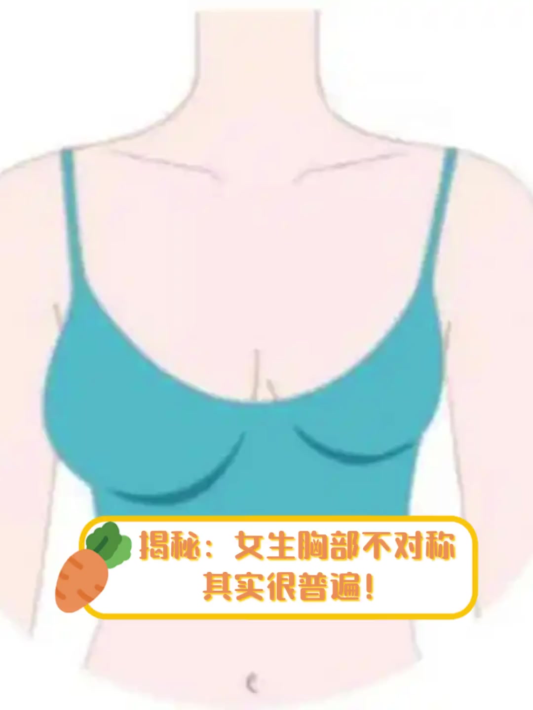 揭秘:女生胸部不对称,其实很普遍!