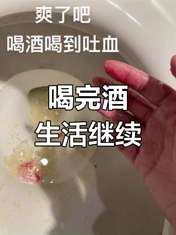 喝酒后的日常,又活过了一天