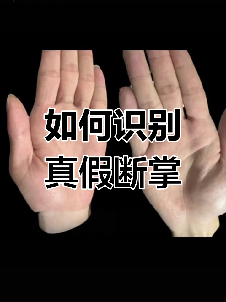 断掌纹的秘密:如何辨别真假断掌