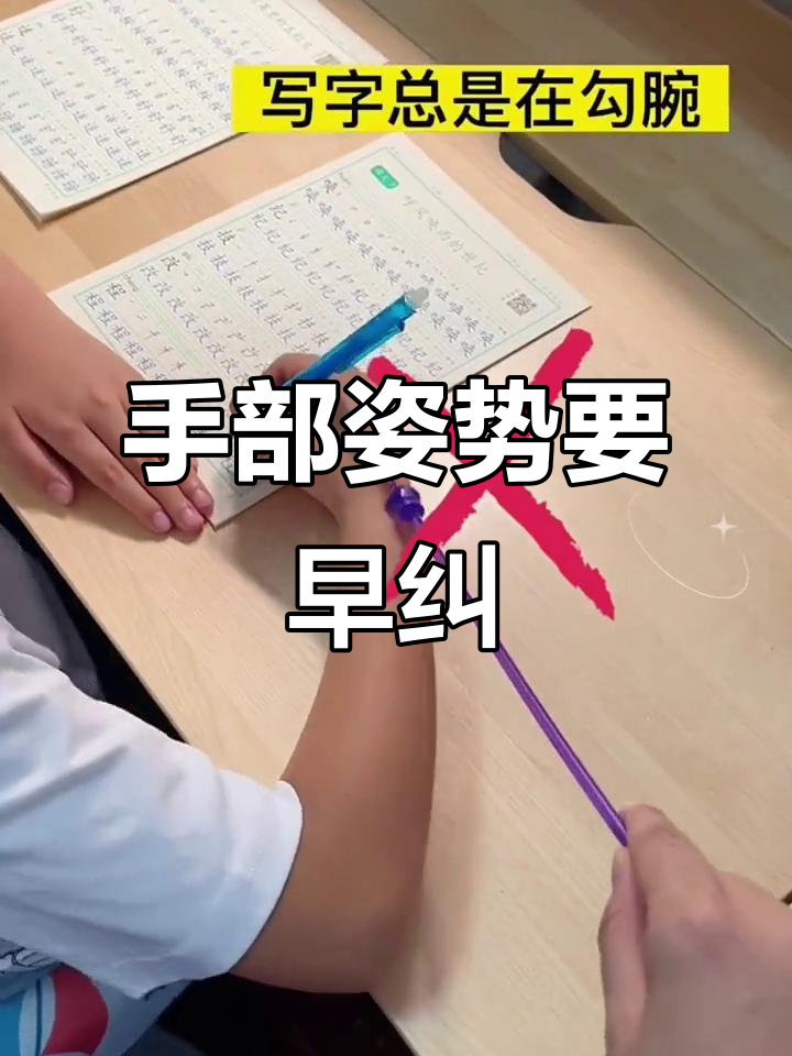 宝妈们,孩子勾腕要及时纠正,避免影响手部发育!