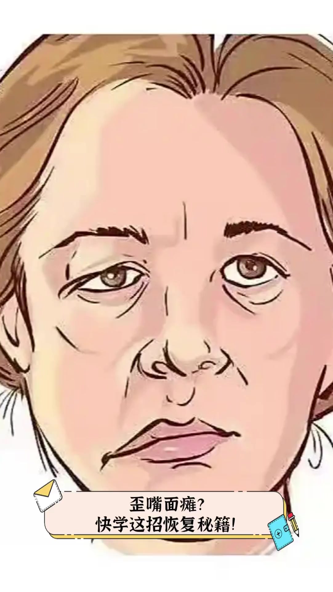 歪嘴面瘫?快学这招恢复秘籍!