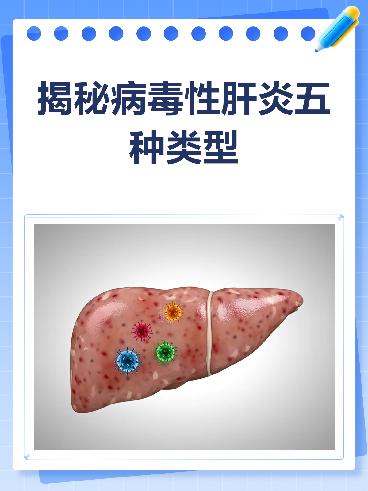 病毒性肝炎知多少?类型,症状一网打尽!