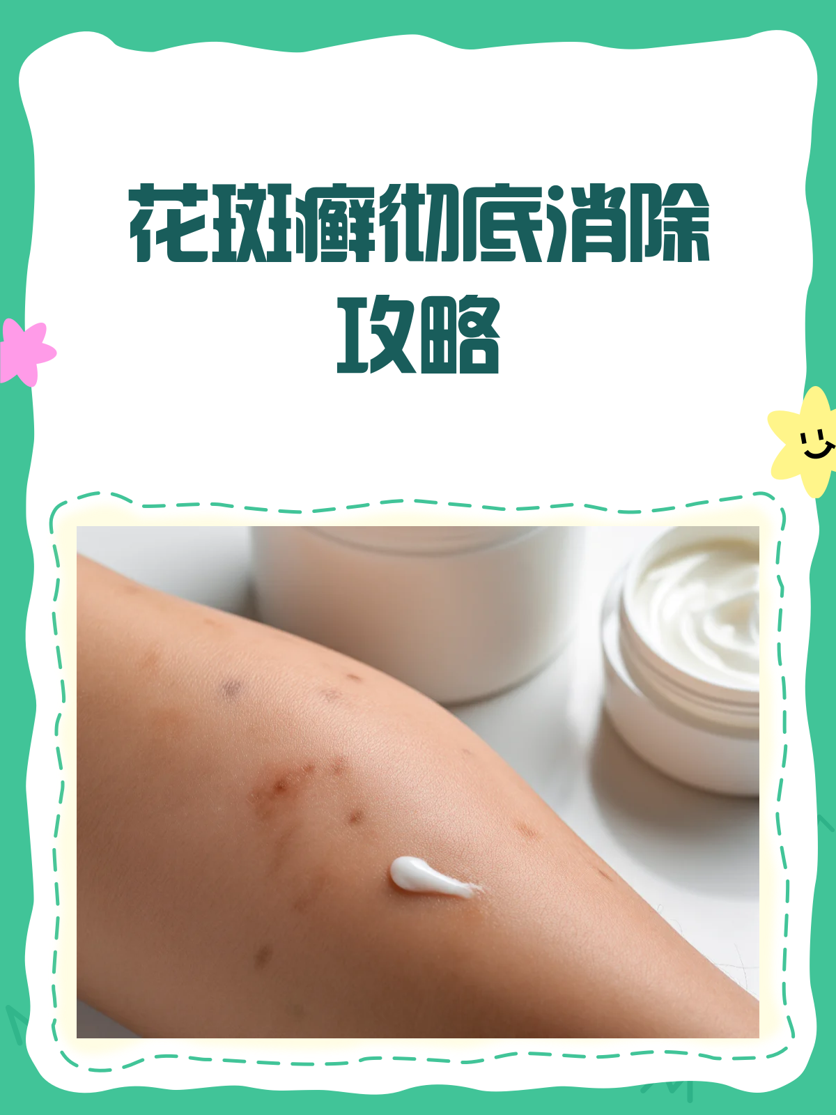 花斑癣烦恼多?这样治,彻底告别它!