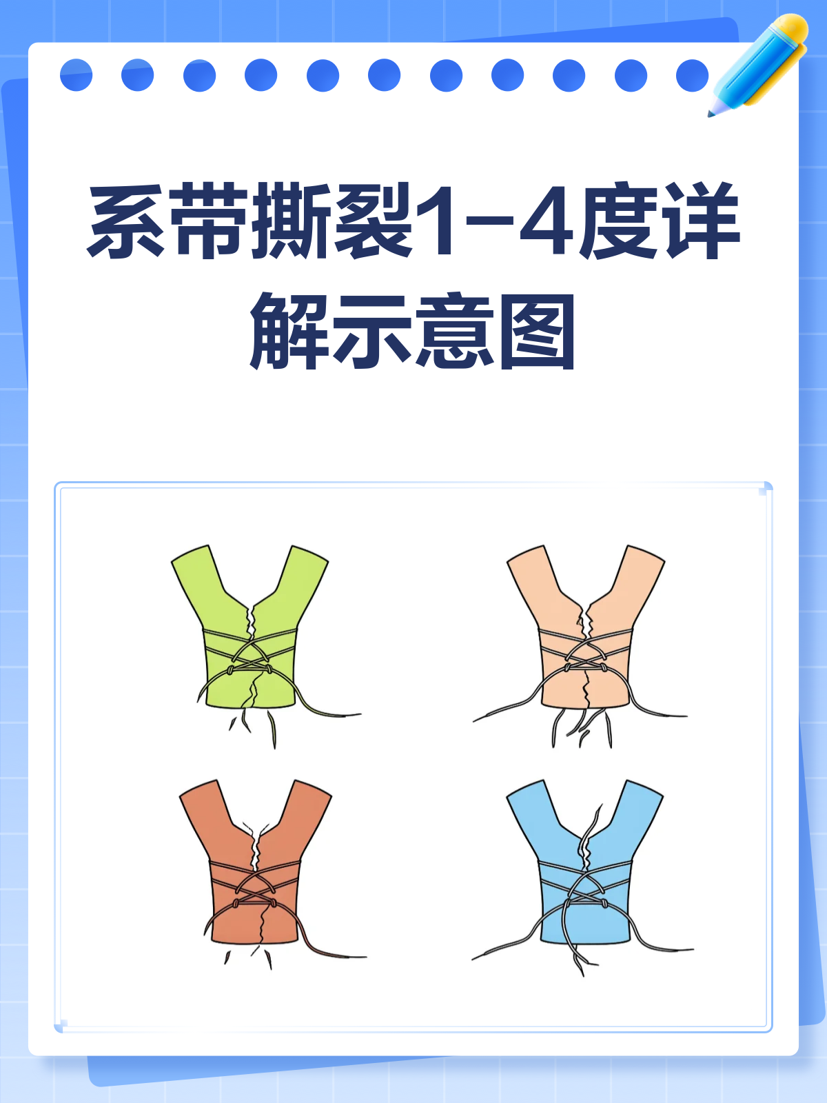 系带撕裂分几度?一张图给你讲明白!