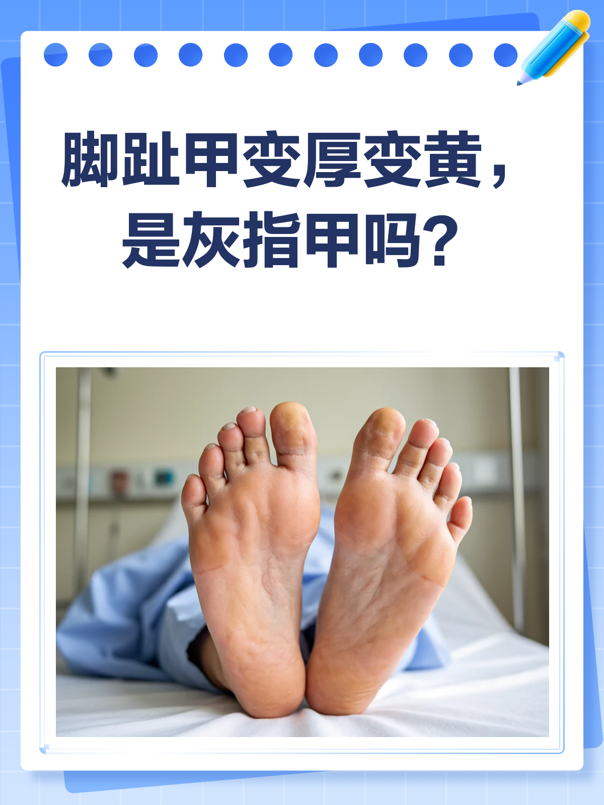 为什么指甲发黄不干净百科在线
