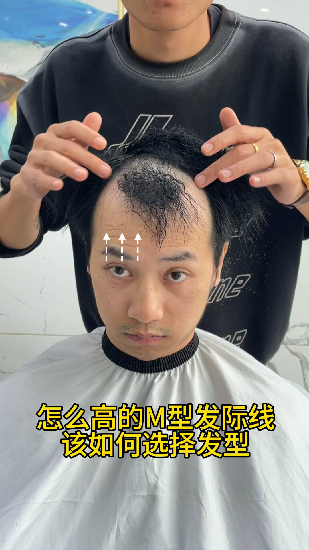 男士头发少额头高弄什么发型年轻好看