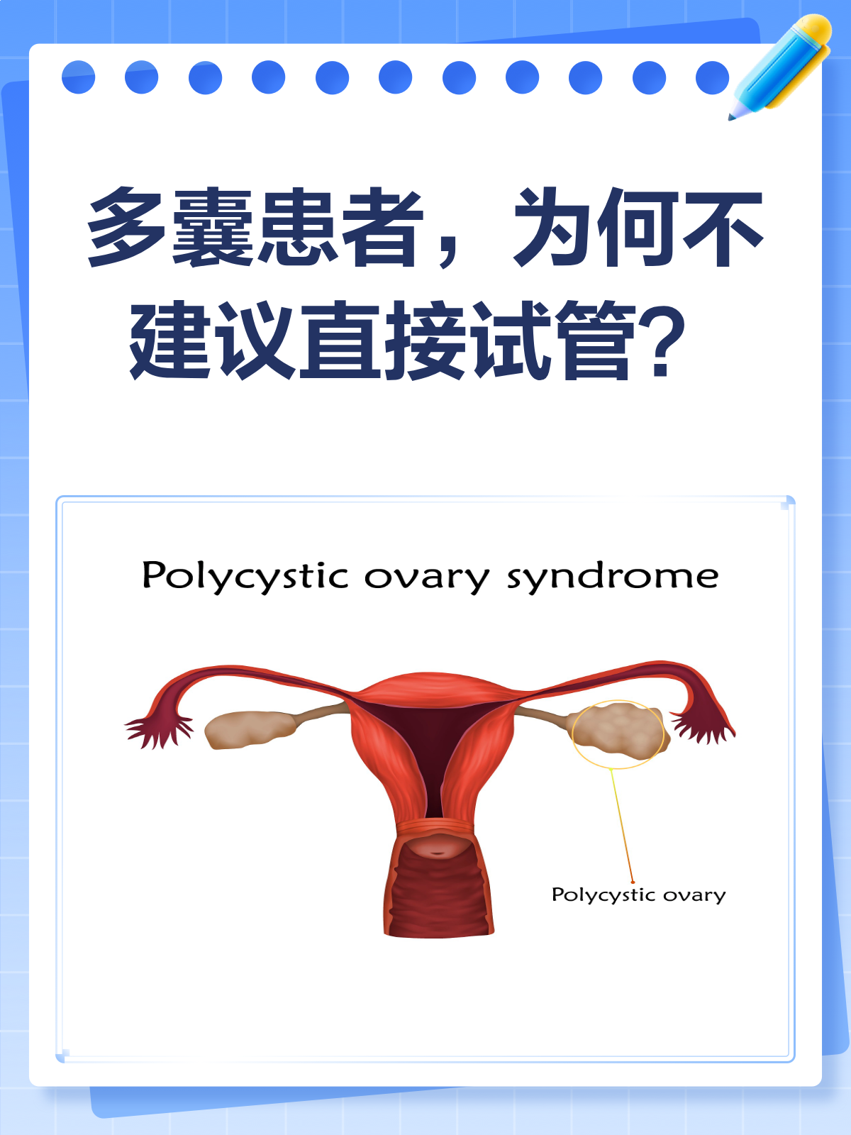 多囊可以试管(多囊可以试管嘛)  第2张