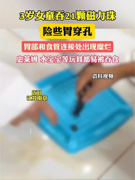 吞了磁力珠怎么办_吞了磁力珠怎么办才华

消化