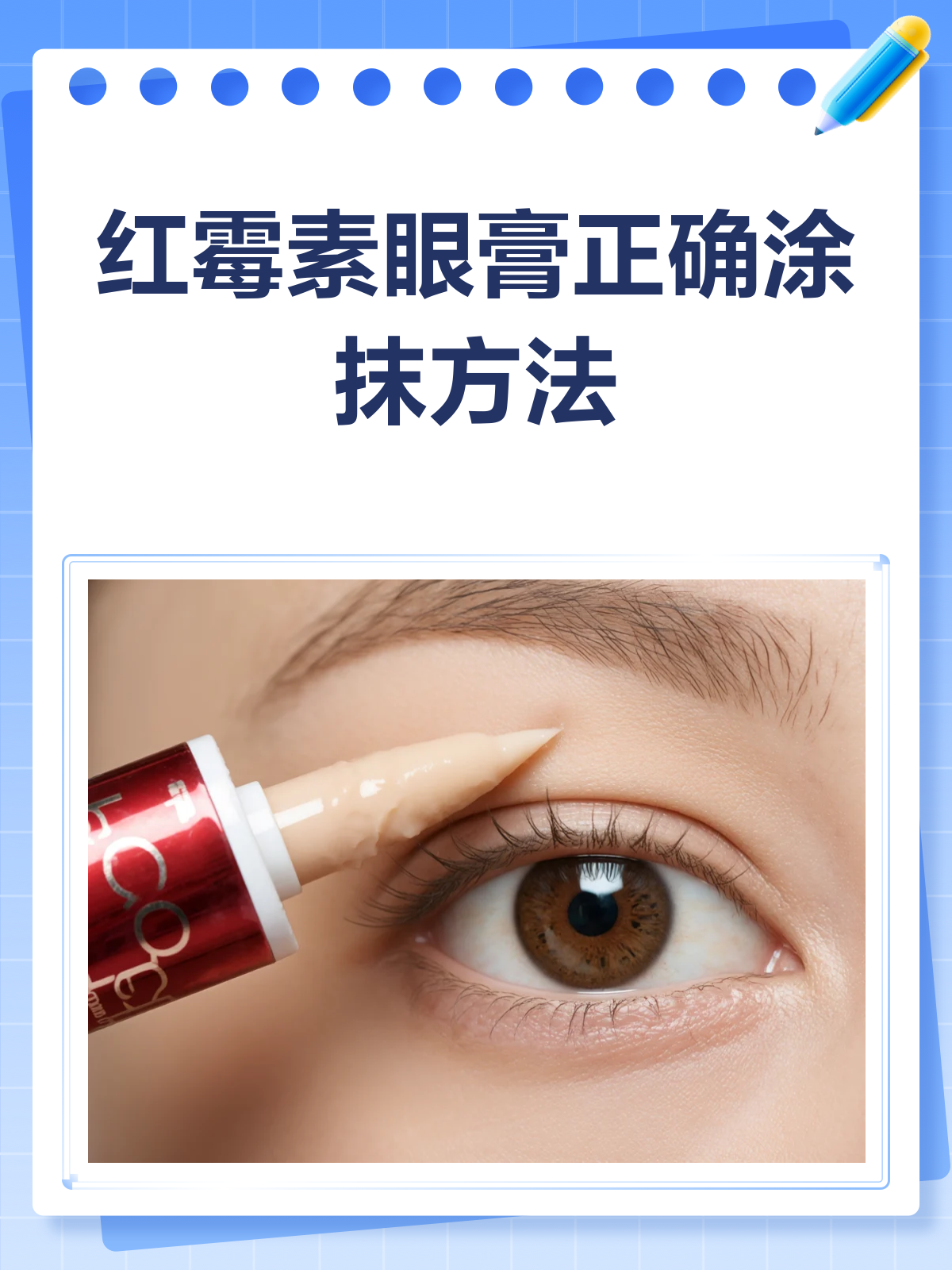 红霉素眼膏涂法不难.涂前洗净双手,避免感染