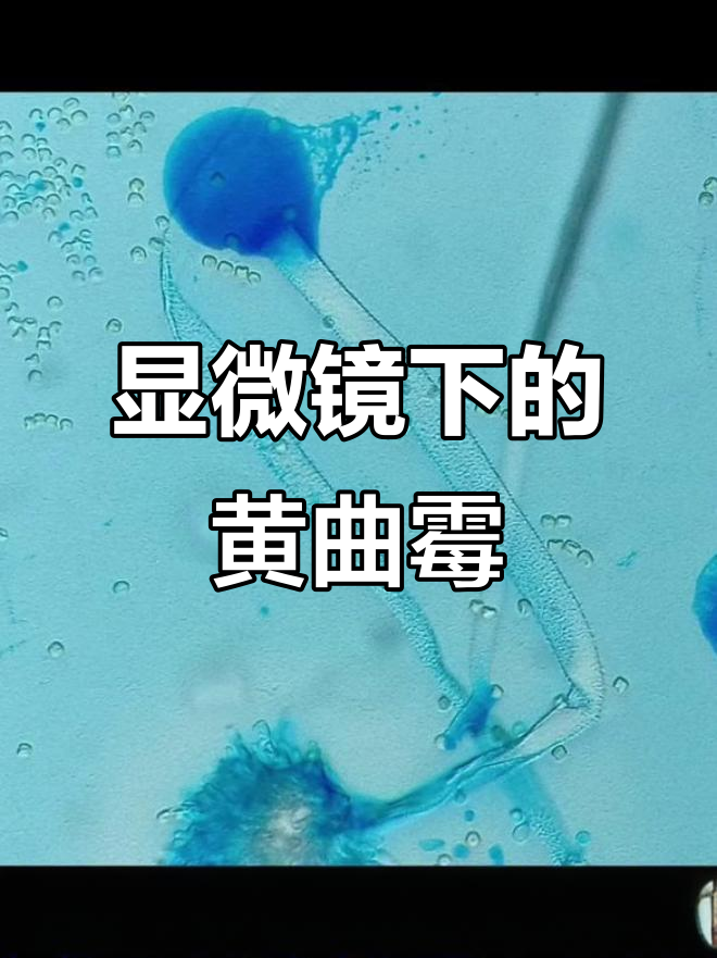 黄曲霉在显微镜下,细节难以察觉,一张图让你轻松看清!