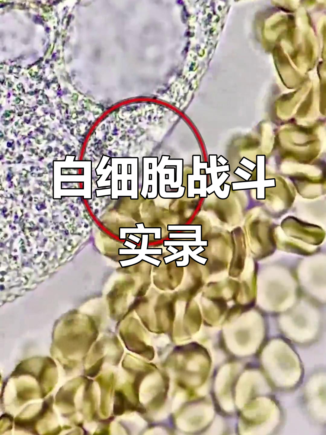 白细胞如何与寄生虫搏斗,守护身体健康?