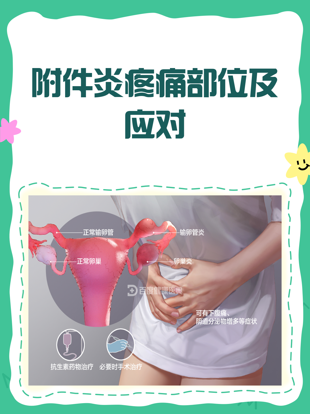 揭秘附件炎,肚子哪里最"受伤"?