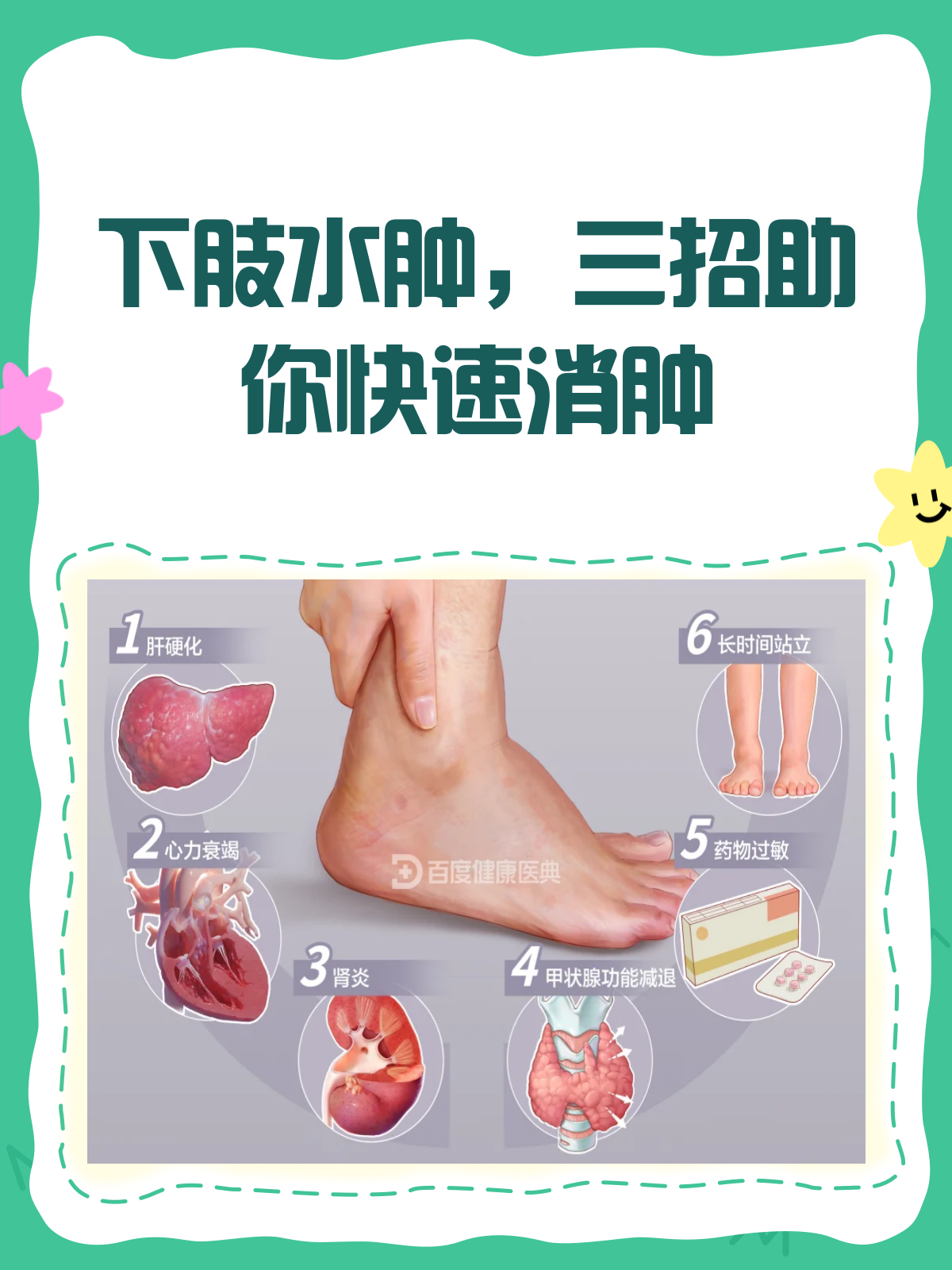 为什么容易水肿的人吃榴莲会消肿百科在线