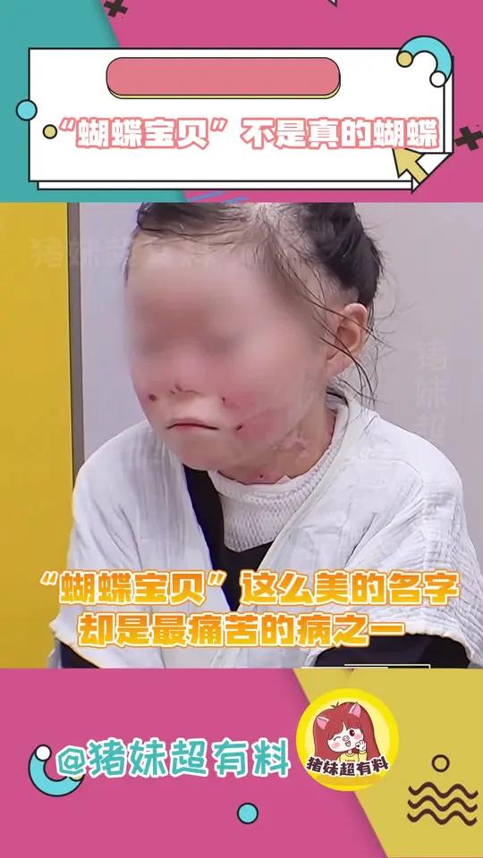 所有人远离疾病,父母家人平安健康长命百岁 闪闪的儿科医生 蝴蝶宝贝