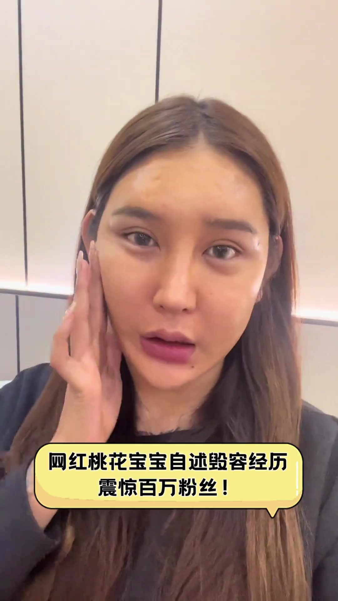 网红桃花宝宝自述毁容经历,震惊百万粉丝!