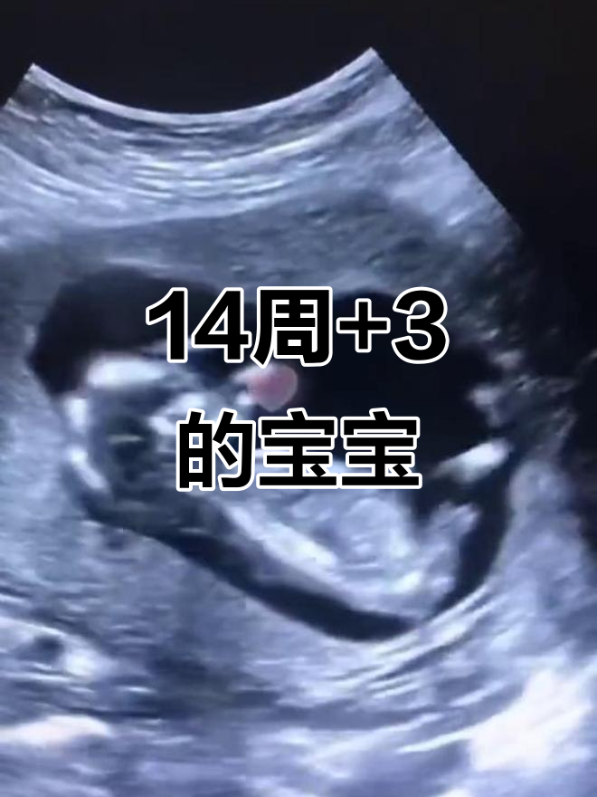 14周 3胎儿发育,妈妈们了解吗?