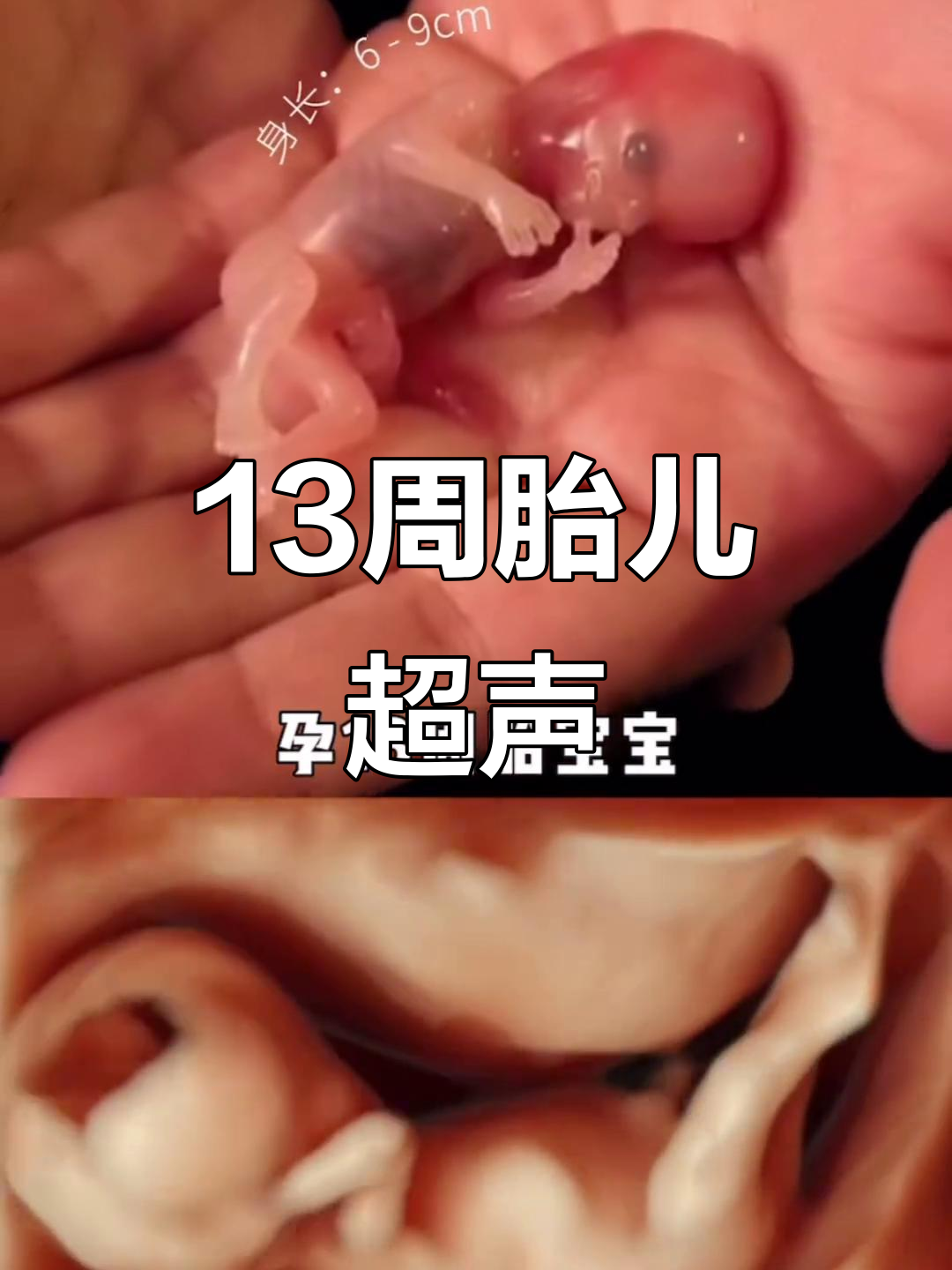13周胎儿超声影像,真实呈现宝宝模样