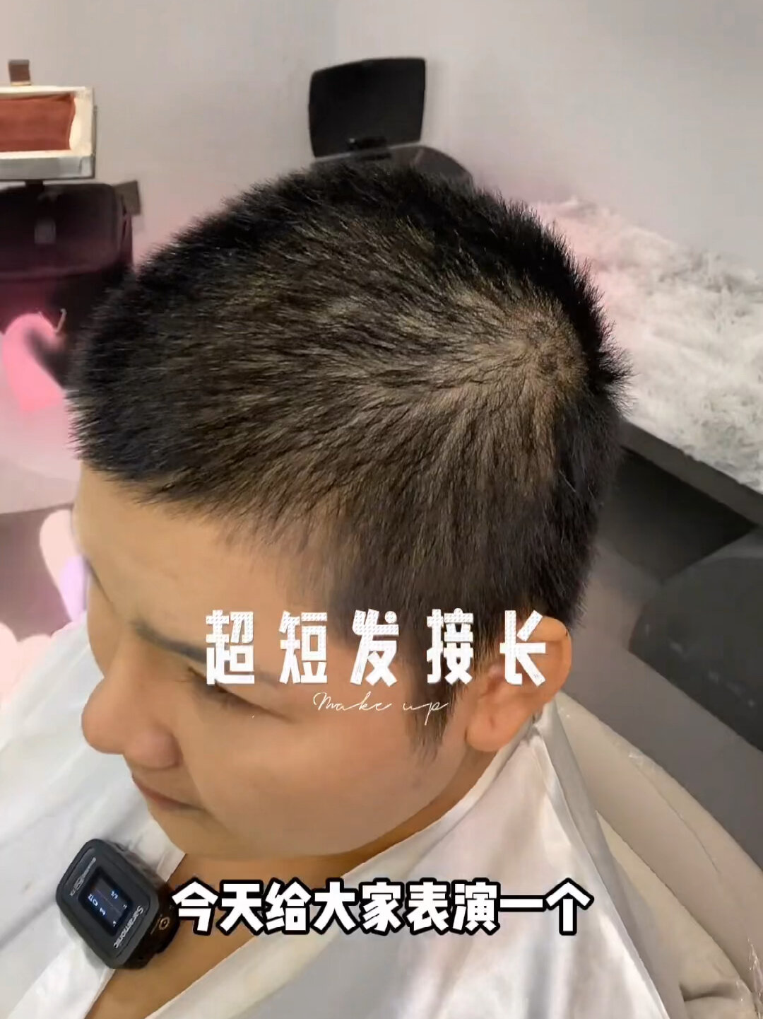 寸头接发 头发一厘米也可以接发