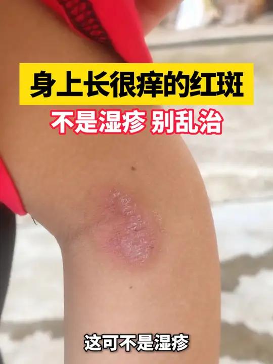身上为什么老是痒