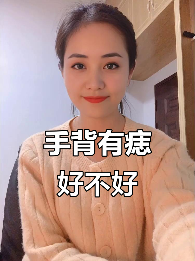 手背痣的寓意与财运关系,你的痣长在哪里?