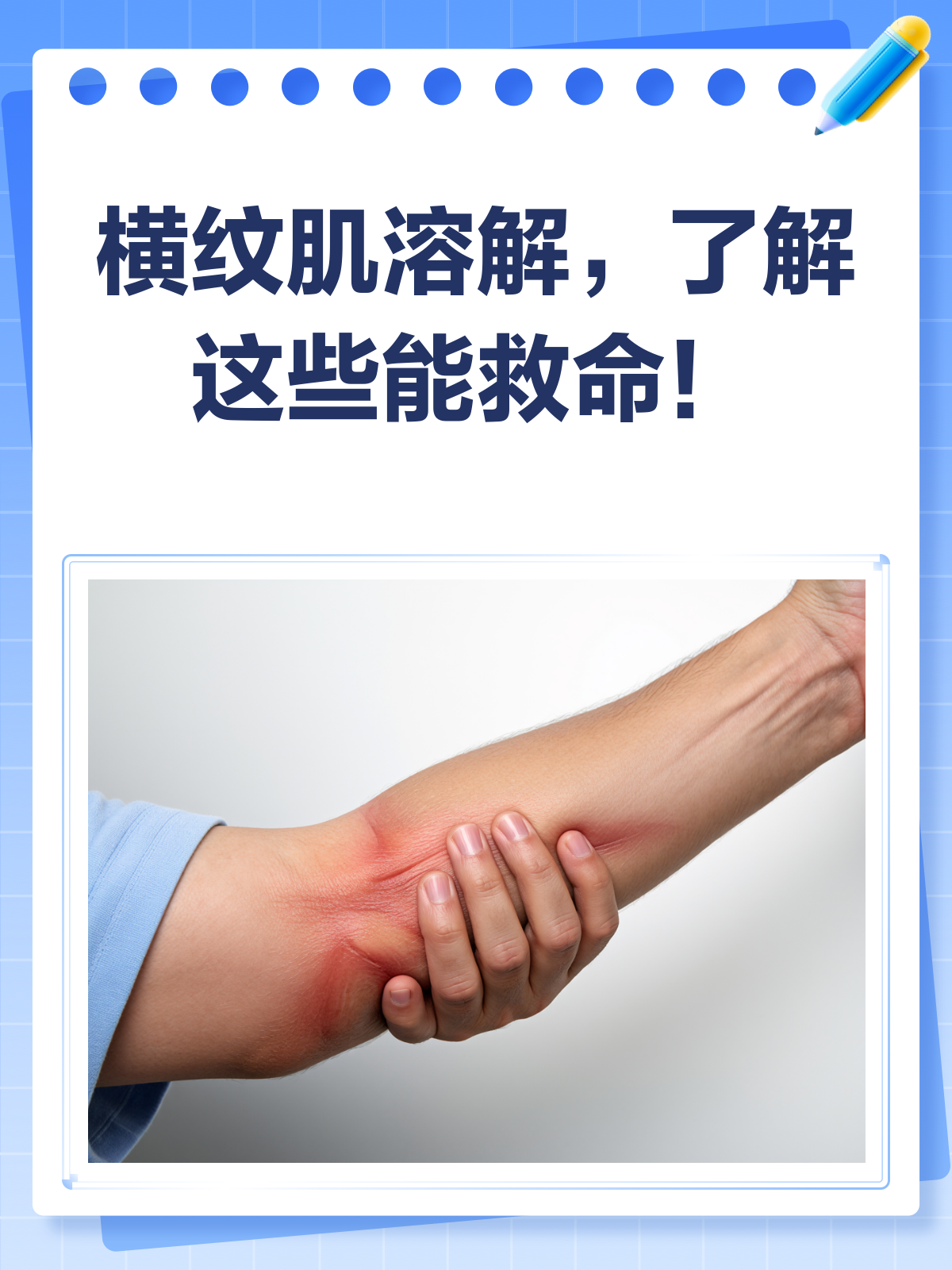 横纹肌溶解,肌肉也会"罢工"?