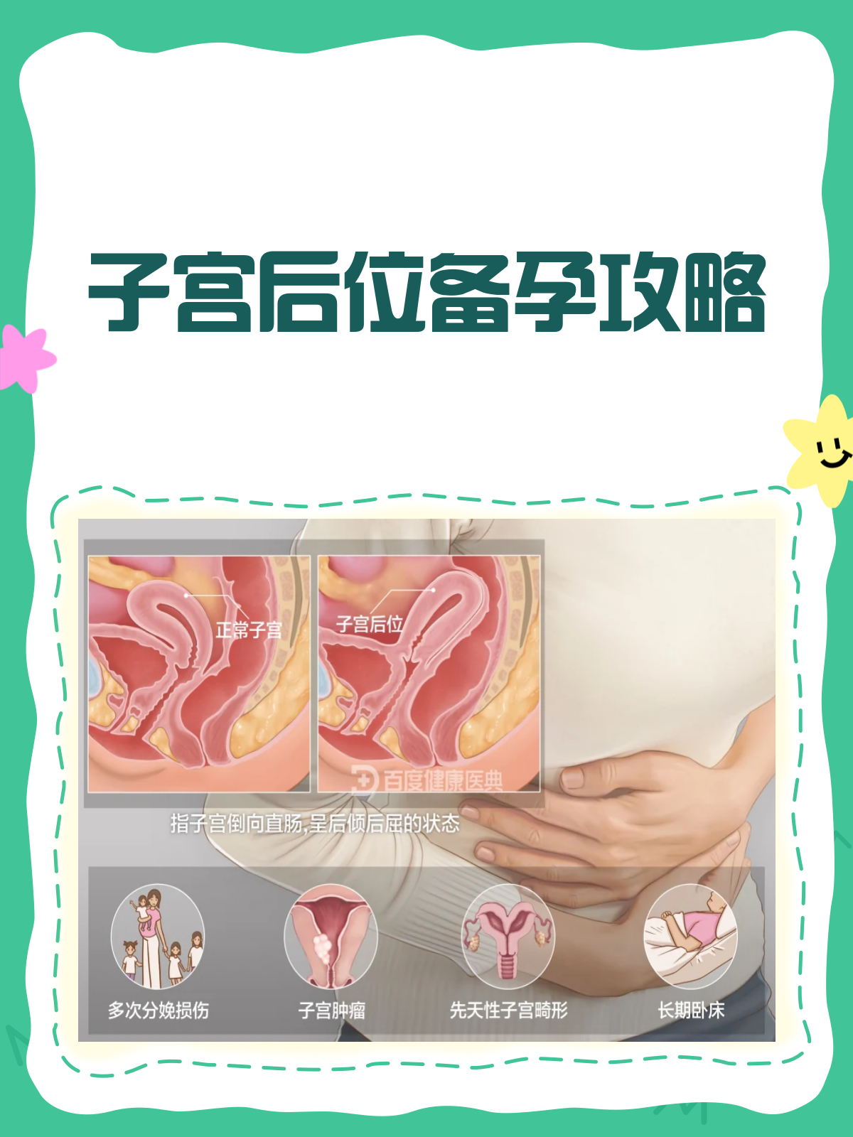 子宫后位备孕难?这几招助你轻松好孕!
