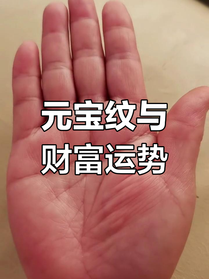 手掌元宝纹揭示富贵命运,三角纹带来好运