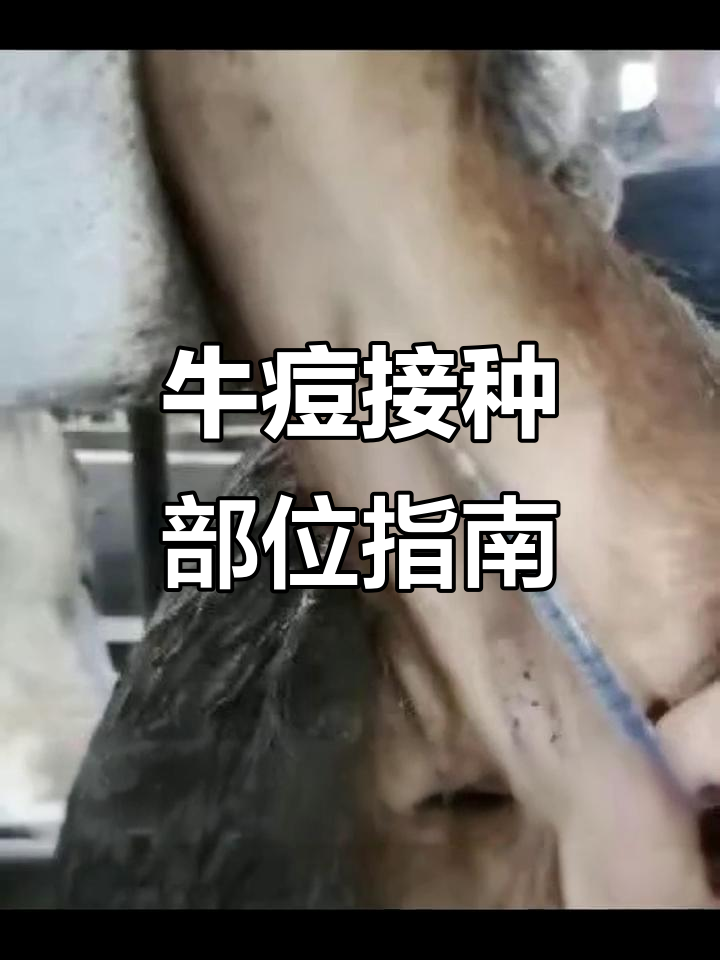 牛痘疫苗注射的正确位置,避免误打