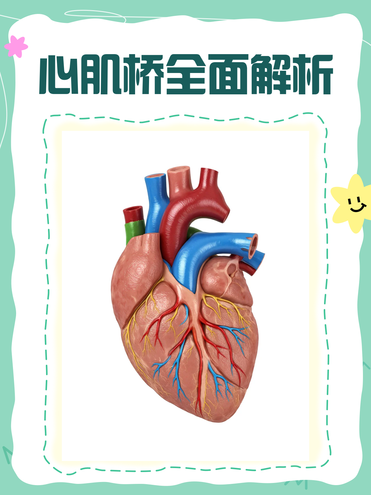 心肌桥揭秘!这种心脏病你了解多少?