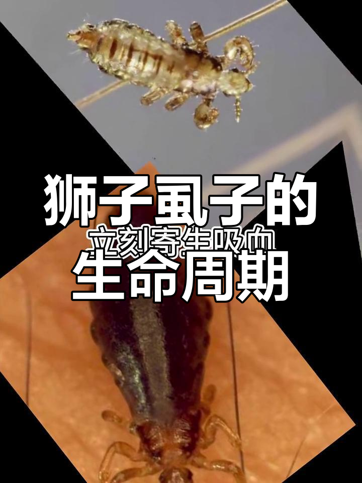 狮子虱子:从成虫到幼虫的成长与驱除方法