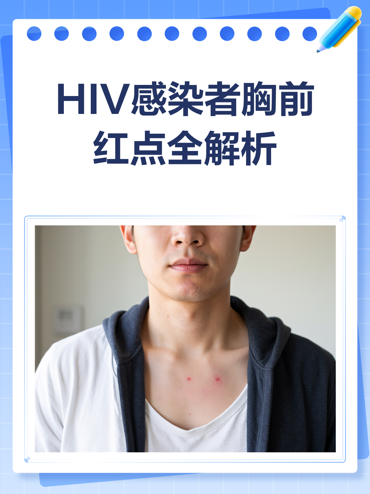 hiv感染者胸前红点,是信号还是迷雾?
