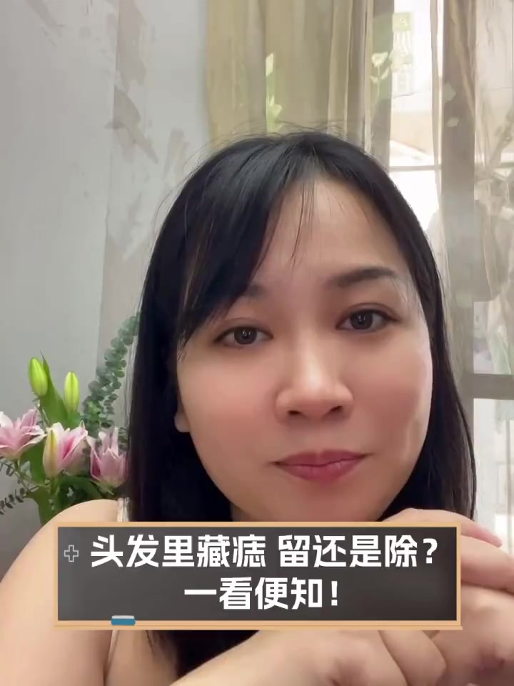 头发里长痣的女人图片