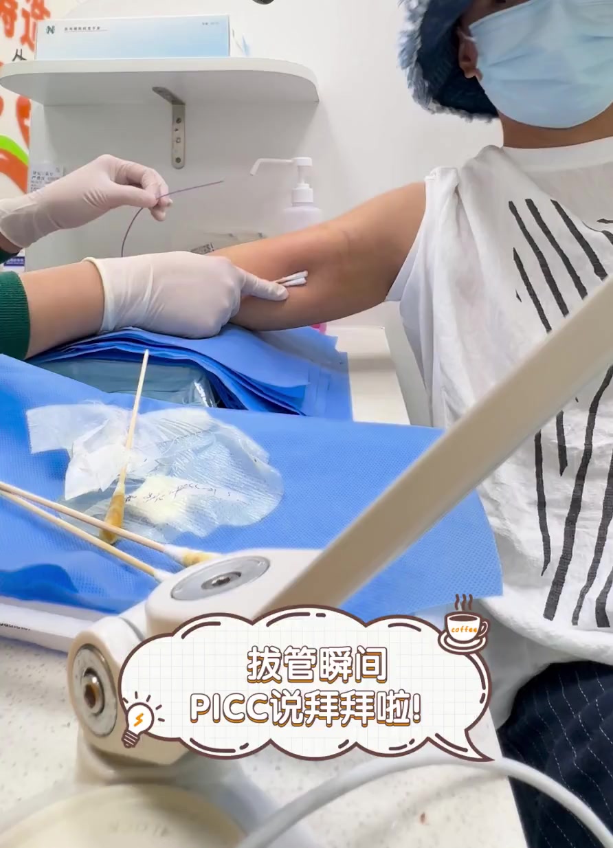 picc导管完整拔出图片