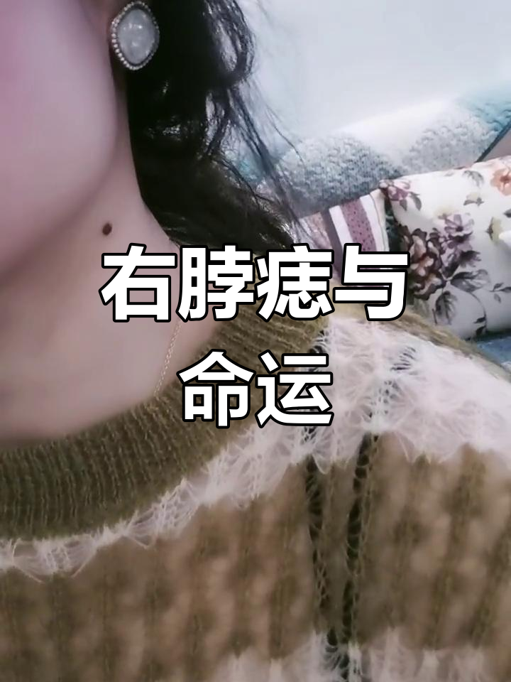 脖子右侧有痣,真的是福气满满吗?