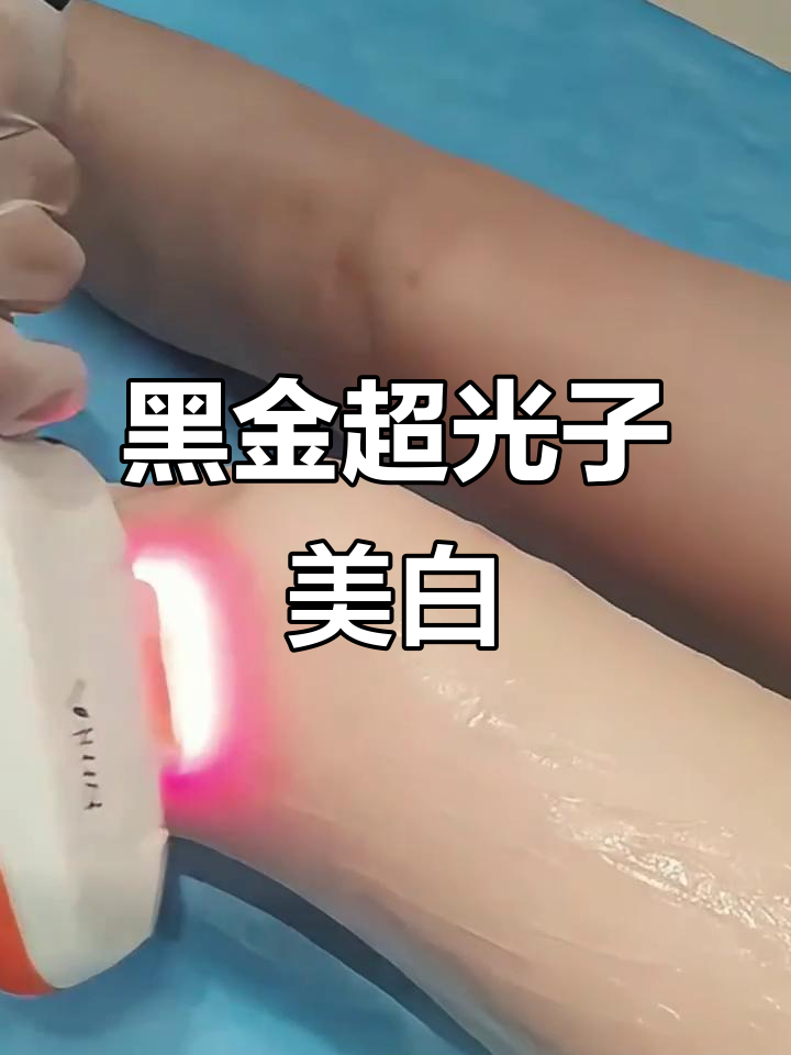深圳全身黑金超光子,美白效果惊艳!