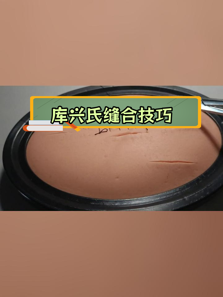 库兴氏缝合法:精神状态的稳定应用