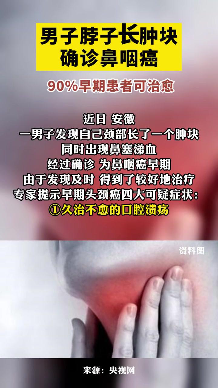 男子脖子长肿块确诊鼻咽癌90早期患者可治愈