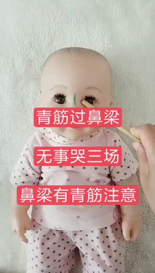 鼻梁上有青筋图片