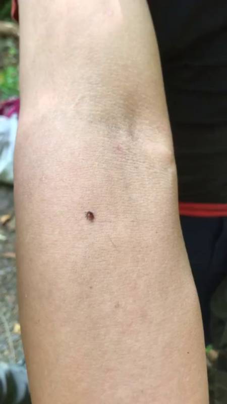 草爬子,学名蜱冲,深林中一种可怕的小虫子-度小视