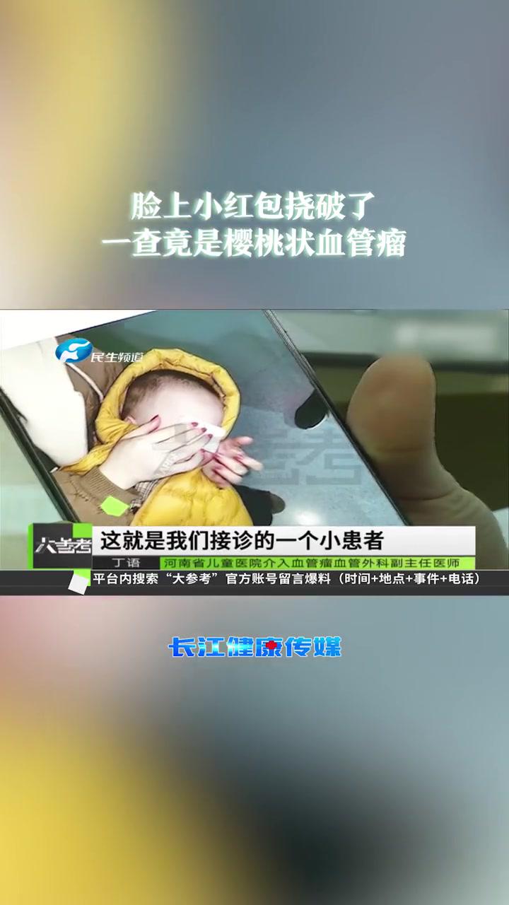 脸上小红包挠破了一查竟是樱桃状血管瘤医学科普健康科普来源河南民生