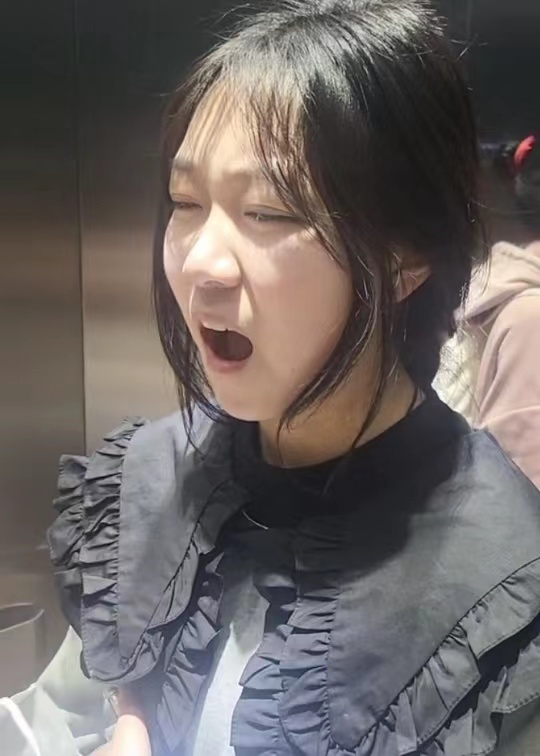 女生打哈欠下巴脱臼,不忘让拍视频的朋友开美颜