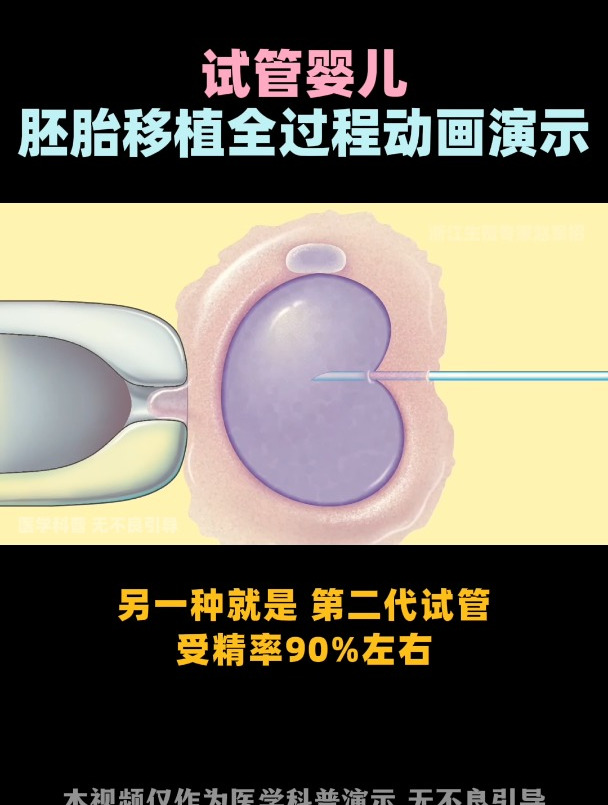 试管婴儿 3d视频演示