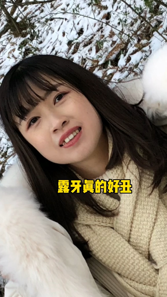 牙套三年的变化我算逆袭成功吗大圆脸变瓜子脸啦