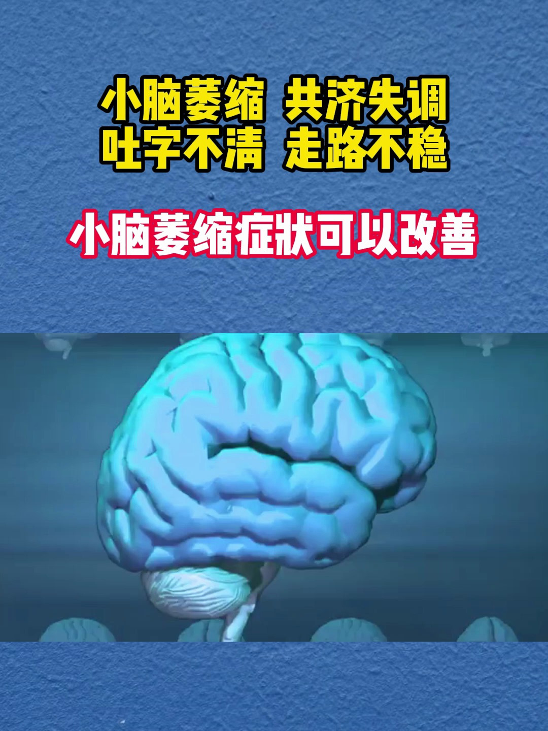 小脑萎缩可以改善