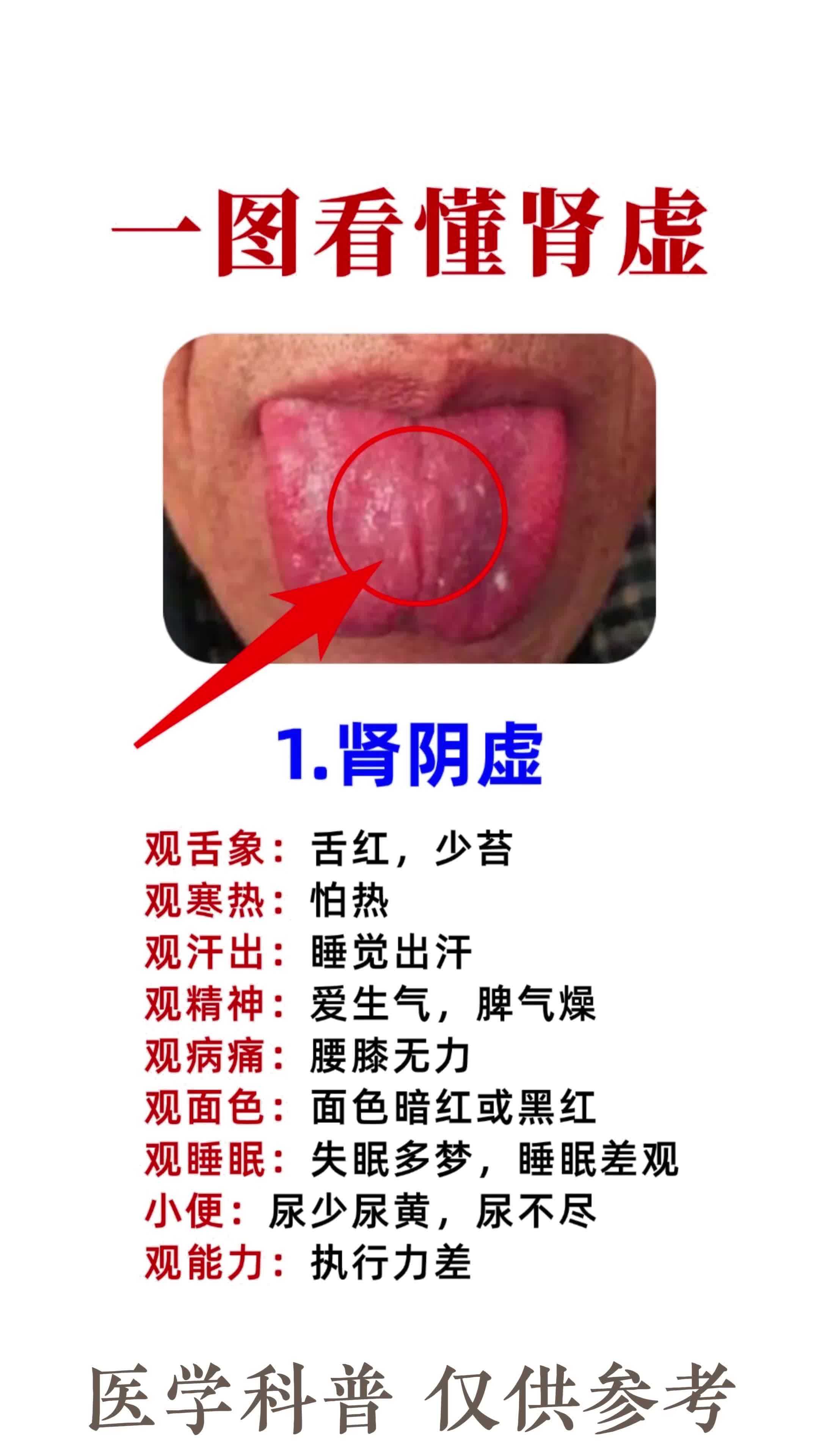 一图教你看懂肾阴虚和肾阳虚的区别!